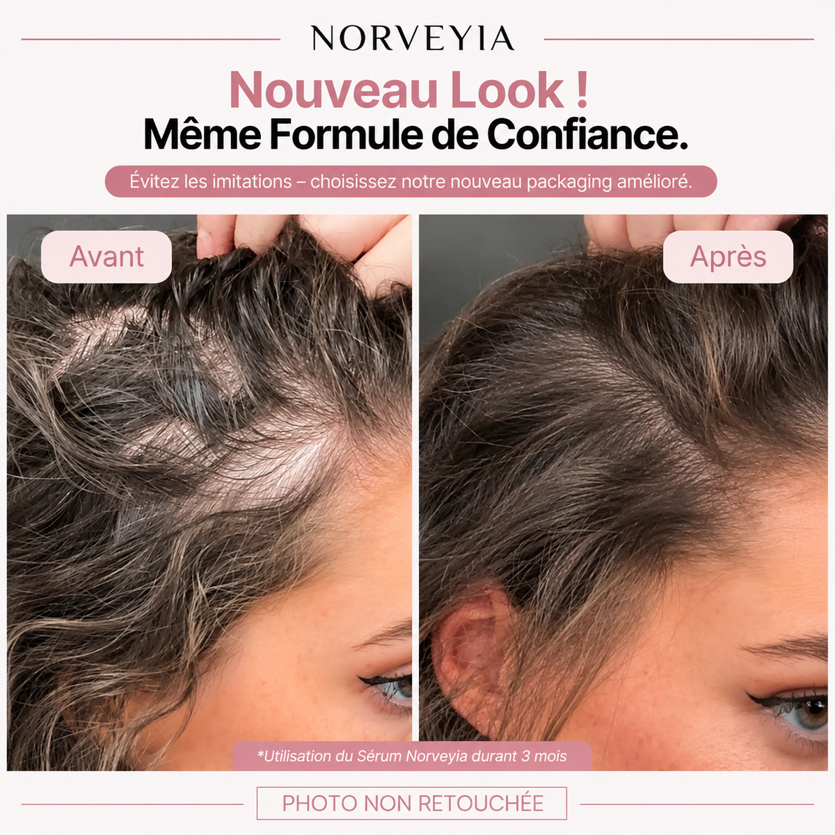 Sérum Capillaire Norvelyia™
