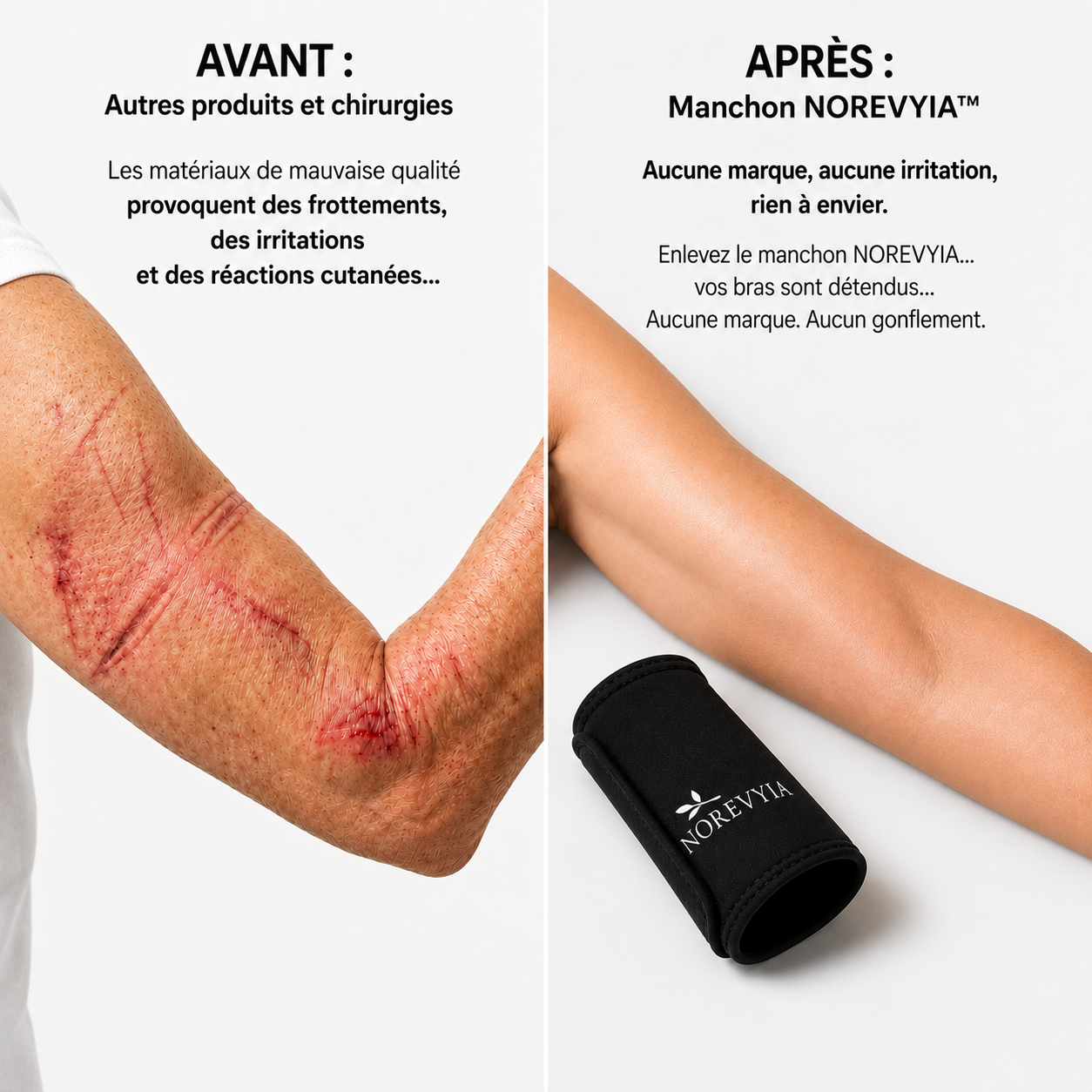 Manchons Raffermissants pour les Bras NOREVYIA™