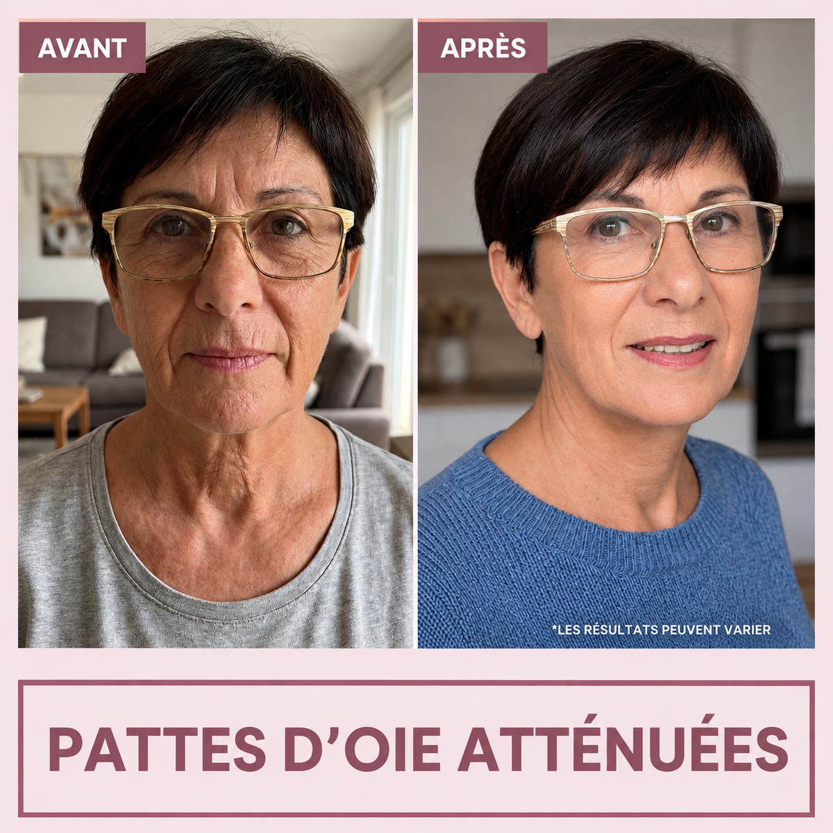 Ampoule Coréenne au Collagène — Effet Lifting dès la Première Application | NOREVYIA