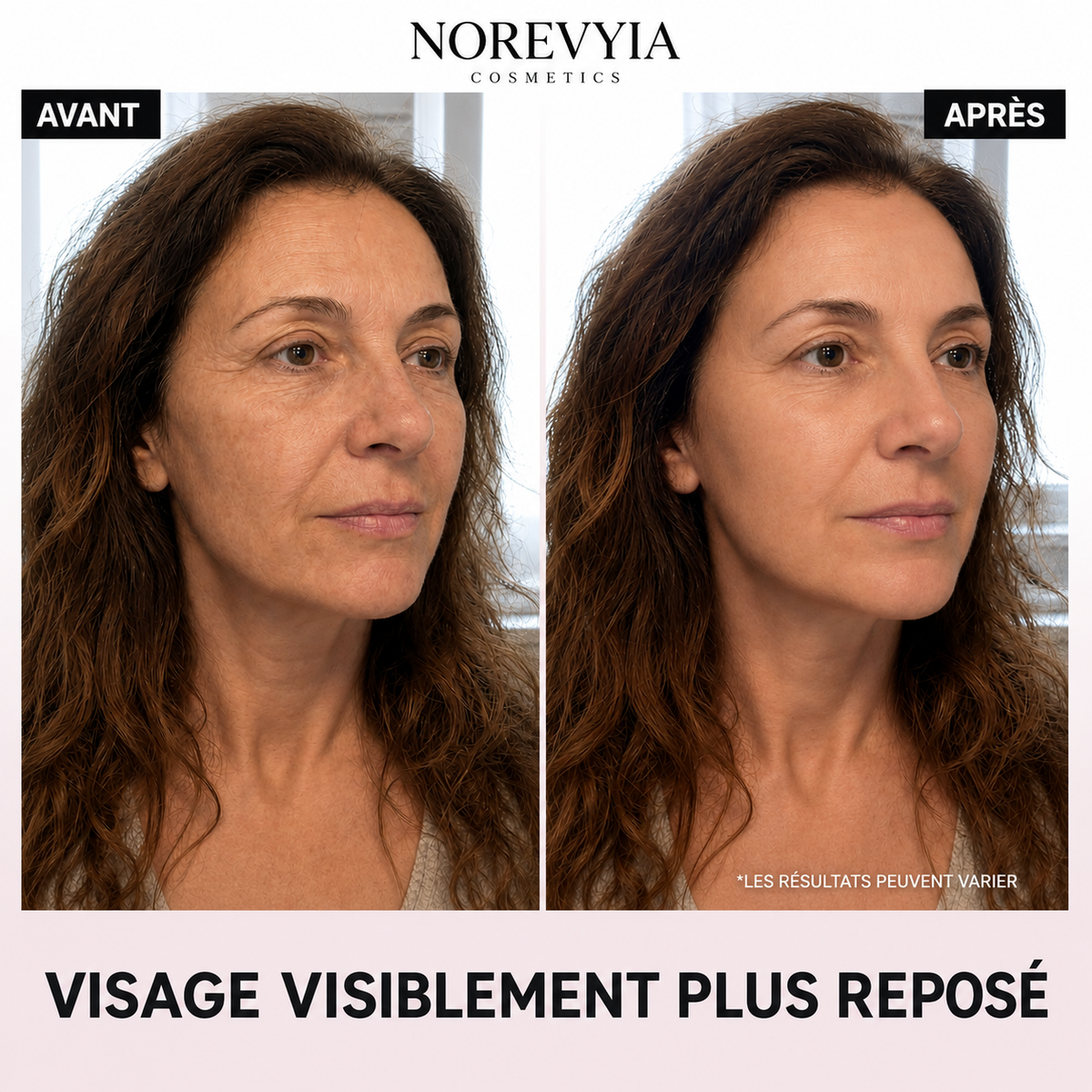 Ampoule Coréenne au Collagène — Effet Lifting dès la Première Application | NOREVYIA