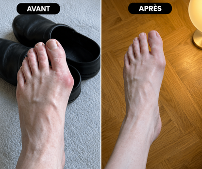 Il tient votre orteil. Et il rééduque le muscle qui doit le tenir.