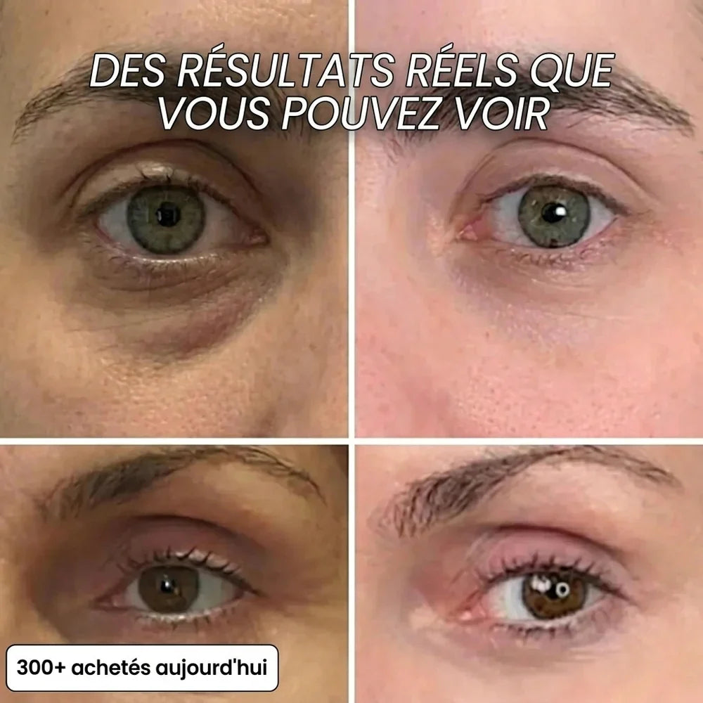 by Norevyia™ — Stick Repulpant PDRN au Bio-Collagène