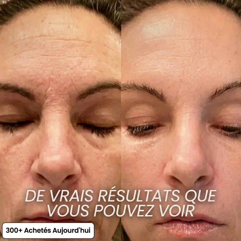 by Norevyia™ — Stick Repulpant PDRN au Bio-Collagène