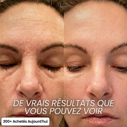 by Norevyia™ — Stick Repulpant PDRN au Bio-Collagène